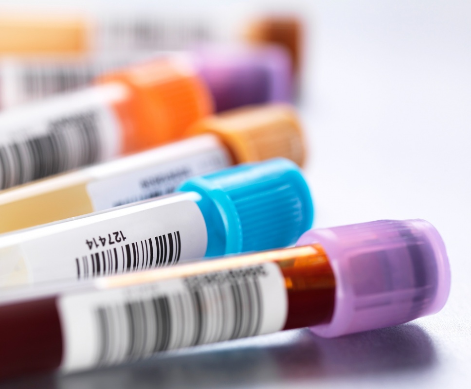 bloodtests-d6ee6fcd59054d4701fa3ee052ce7aad43311500.jpg