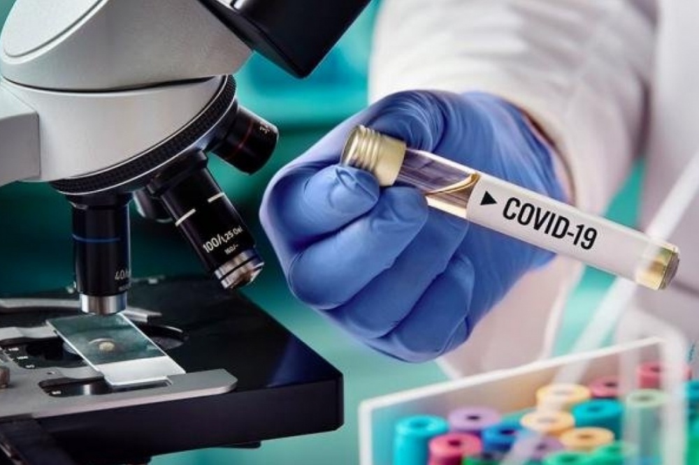 doslidgennya-na-covid-19-u-ternopoli