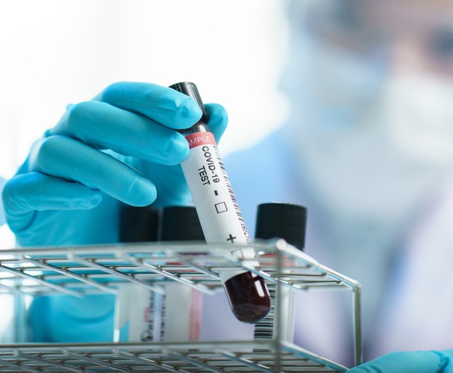 statistika-koronavirus-07_05_2021.jpg