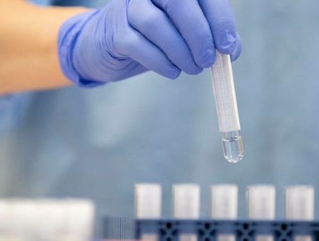 statistika-koronavirus-09_12_2020r_.jpg