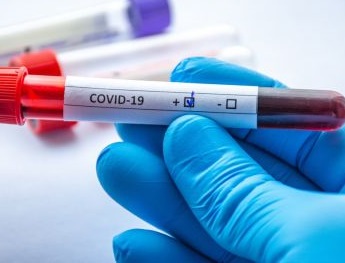 statistika-koronavirus-18_11_2020r_.jpg