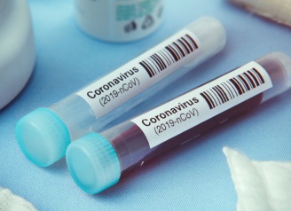 statistika-koronavirus-2-listopada-2020-roku.jpg