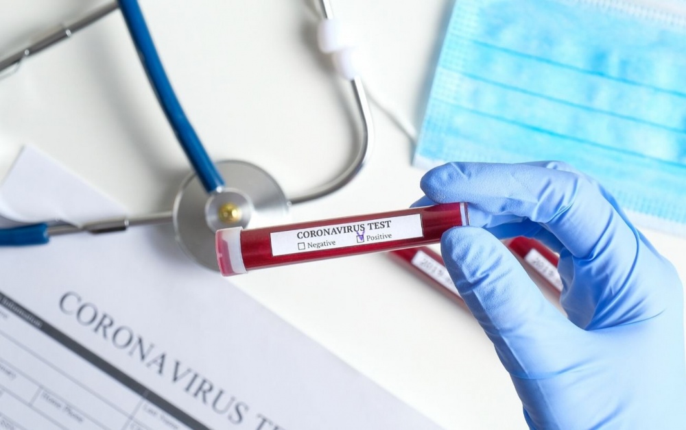 test-na-koronavirus-ternopil-12_05_2020r