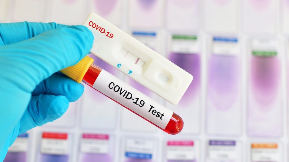 testi-na-koronavirus-06-05-2020